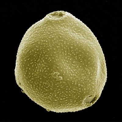 Пыльца форум. Пыльца березы микроскопом. Пыльца березы под микроскопом. Пыльца в микроскопе. Пыльца растений под микроскопом.